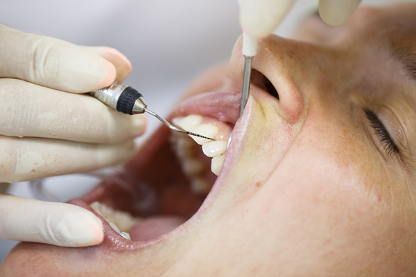 Periodontics for gum health and treatment at Srivari Dental Clinic.
